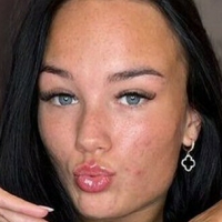 Алексисборедд Голая