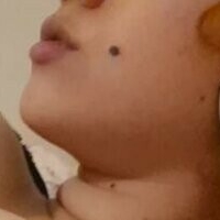 Эггалайки Голая