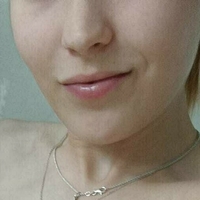 Фоси Голая