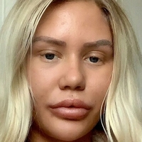 хлоэниемела Голая