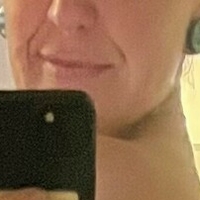 Нотсопоси Голая