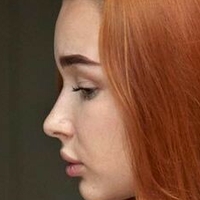 хбордерлайн Голая
